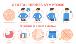 Myths about herpes