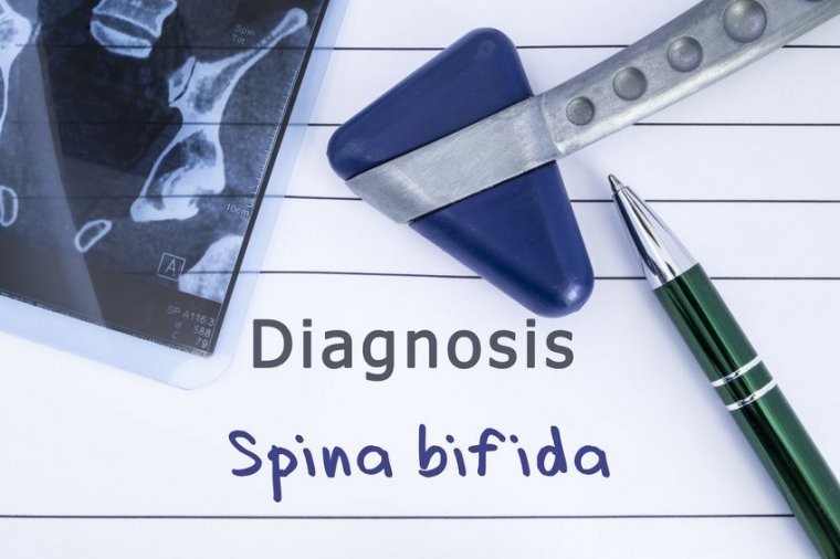 Spina Bifida And Sex